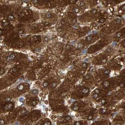 Immunohistochemistry-Paraffin: Cystathionase Antibody [NBP1-86016]