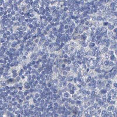 Immunohistochemistry-Paraffin: Cystathionase Antibody [NBP1-86016]