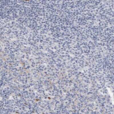 Immunohistochemistry-Paraffin: Cystathionase Antibody [NBP1-90362]