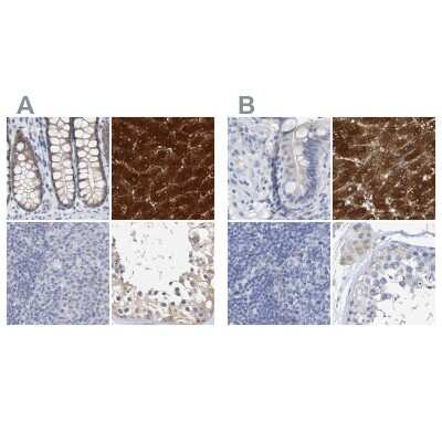 Immunohistochemistry-Paraffin: Cystathionase Antibody [NBP1-90362]