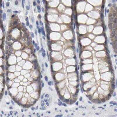 Immunohistochemistry-Paraffin: Cystathionase Antibody [NBP1-90362]