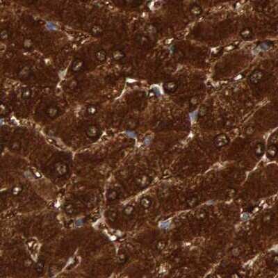 Immunohistochemistry-Paraffin: Cystathionase Antibody [NBP1-90362]