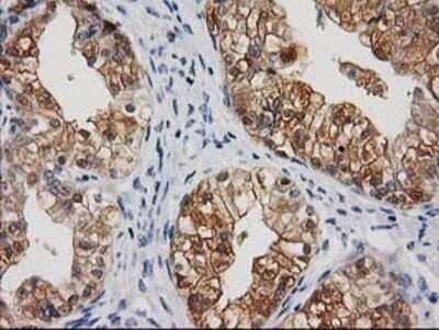 Immunohistochemistry: Cystathionase Antibody (OTI1E12) - Azide and BSA Free [NBP2-70488]