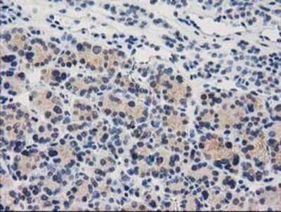 Immunohistochemistry: Cystathionase Antibody (OTI1E12) - Azide and BSA Free [NBP2-70488]