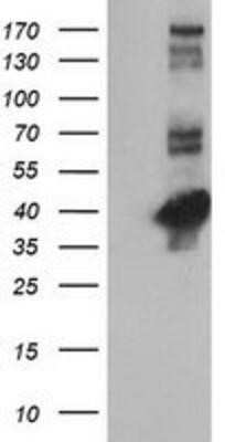 Western Blot: Cystathionase Antibody (OTI1E12)Azide and BSA Free [NBP2-70488]