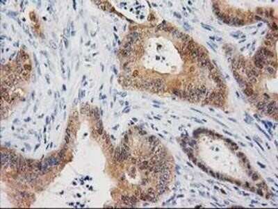 Immunohistochemistry-Paraffin: Cystathionase Antibody (OTI1E12) [NBP2-03638]
