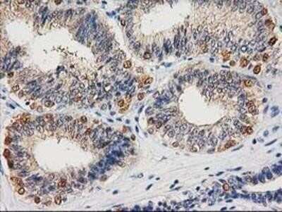 Immunohistochemistry-Paraffin: Cystathionase Antibody (OTI1E12) [NBP2-03638]