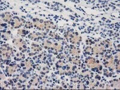 Immunohistochemistry-Paraffin: Cystathionase Antibody (OTI1E12) [NBP2-03638]