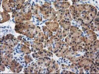 Immunohistochemistry-Paraffin: Cystathionase Antibody (OTI1E12) [NBP2-03638]