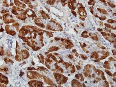 Immunohistochemistry-Paraffin: Cystathionase Antibody (S51) [H00001491-M03]