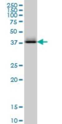 Western Blot: Cystathionase Antibody (S51) [H00001491-M03]