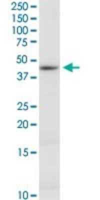 Western Blot: Cystathionase Antibody (S51) [H00001491-M03]