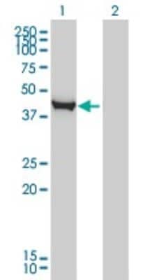 Western Blot: Cystathionase Antibody (S51) [H00001491-M03]