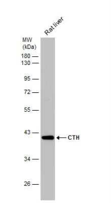 Western Blot: Cystathionase Antibody [NBP1-31759]