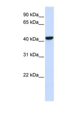 Western Blot: Cystathionase Antibody [NBP1-52849]