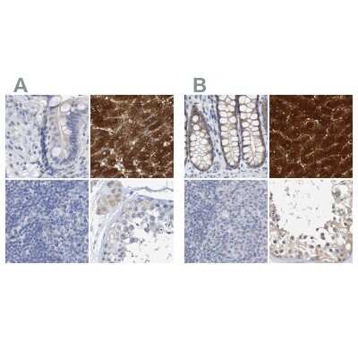 Western Blot: Cystathionase Antibody [NBP1-86016]