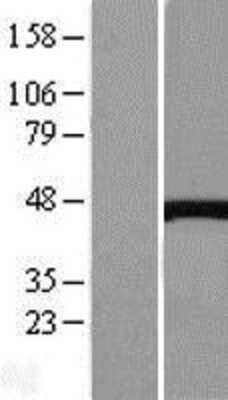 Western Blot: Cystathionase Overexpression Lysate [NBL1-09573]