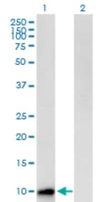 Western Blot: Cystatin-8 Antibody [H00010047-B01P]