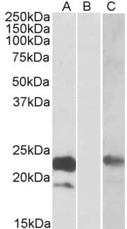 Western Blot: Cystatin-8 Antibody [NBP1-47219]