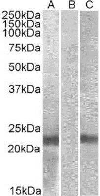 Western Blot: Cystatin-8 Antibody [NBP1-49834]