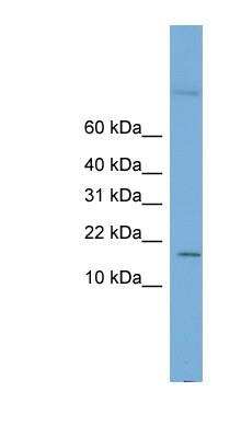 Western Blot: Cystatin-8 Antibody [NBP1-57663]