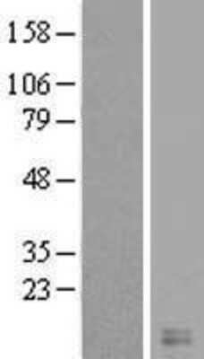 Western Blot: Cystatin-8 Overexpression Lysate [NBL1-09551]