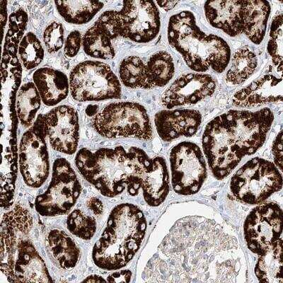 Immunohistochemistry-Paraffin: Cystatin-9 Antibody [NBP1-85565]