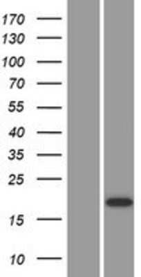 Western Blot: Cystatin-9 Overexpression Lysate [NBP2-11001]