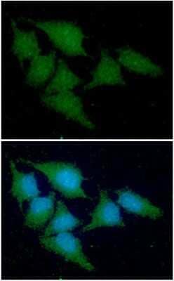 Immunocytochemistry/ Immunofluorescence: Cystatin A Antibody (1B12) - BSA Free [NBP2-59470]