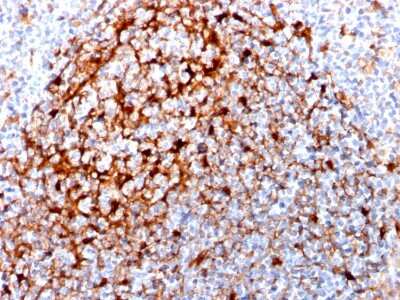 Immunohistochemistry-Paraffin: Cystatin A Antibody (CPTC-CSTA-1) - Azide and BSA Free [NBP3-08498]