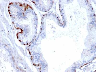 Immunohistochemistry-Paraffin: Cystatin A Antibody (CPTC-CSTA-1) - Azide and BSA Free [NBP3-08498]