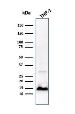 Western Blot: Cystatin A Antibody (CPTC-CSTA-1)Azide and BSA Free [NBP3-08498]