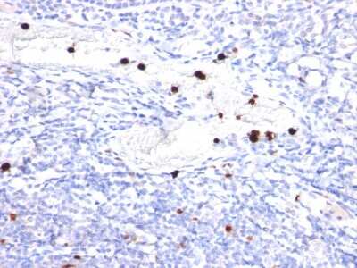 Immunohistochemistry-Paraffin: Cystatin A Antibody (CPTC-CSTA-1) [NBP3-07781]