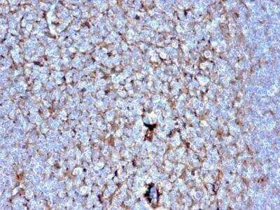 Immunohistochemistry-Paraffin: Cystatin A Antibody (CSTA/2882) - Azide and BSA Free [NBP2-79882]