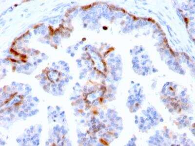 Immunohistochemistry-Paraffin: Cystatin A Antibody (CSTA/2882) - Azide and BSA Free [NBP2-79882]