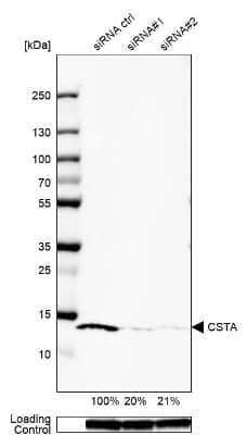 Western Blot: Cystatin A Antibody [NBP1-86989]