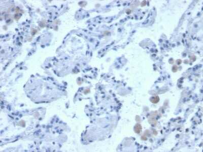 Immunohistochemistry-Paraffin: Cystatin B/Stefin B Antibody (CPTC-CSTB-3) - Azide and BSA Free [NBP3-08538]