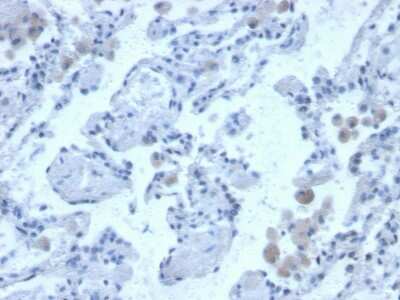 Immunohistochemistry-Paraffin: Cystatin B/Stefin B Antibody (CPTC-CSTB-3) [NBP3-07788]