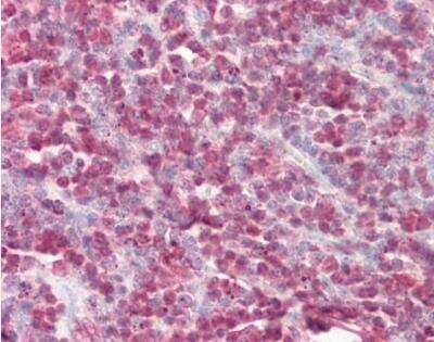 Immunohistochemistry-Paraffin: Cystatin B/Stefin B Antibody [NBP1-31838]