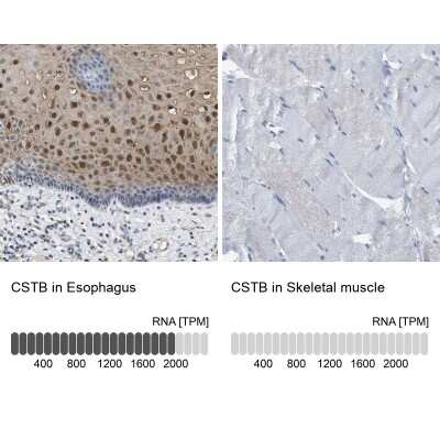 Immunohistochemistry-Paraffin: Cystatin B/Stefin B Antibody [NBP1-85430]