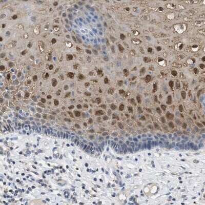 Immunohistochemistry-Paraffin: Cystatin B/Stefin B Antibody [NBP1-85430]
