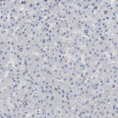 Immunohistochemistry-Paraffin: Cystatin B/Stefin B Antibody [NBP1-85430]