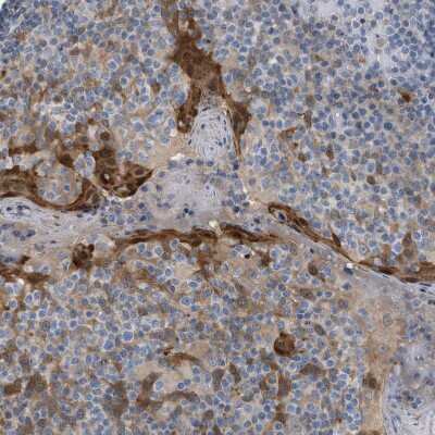 Immunohistochemistry-Paraffin: Cystatin B/Stefin B Antibody [NBP1-85430]