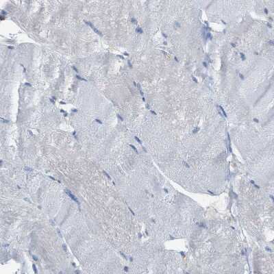 Immunohistochemistry-Paraffin: Cystatin B/Stefin B Antibody [NBP1-85430]