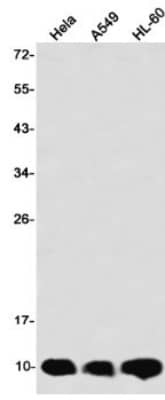 Western Blot: Cystatin B/Stefin B Antibody (S02-7D7) [NBP3-19854]