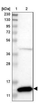 Western Blot: Cystatin B/Stefin B Antibody [NBP1-85430]