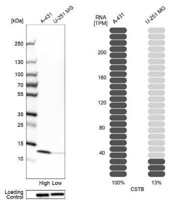 Western Blot: Cystatin B/Stefin B Antibody [NBP1-85430]