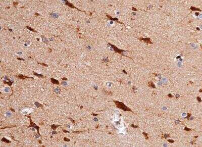 Immunohistochemistry-Paraffin: Cystatin C Antibody (033) [NBP2-89501]