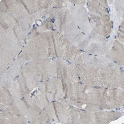 Immunohistochemistry-Paraffin: Cystatin C Antibody [NBP1-87472]