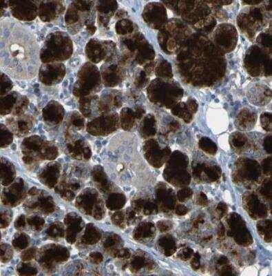 Immunohistochemistry-Paraffin: Cystatin C Antibody [NBP1-87472]